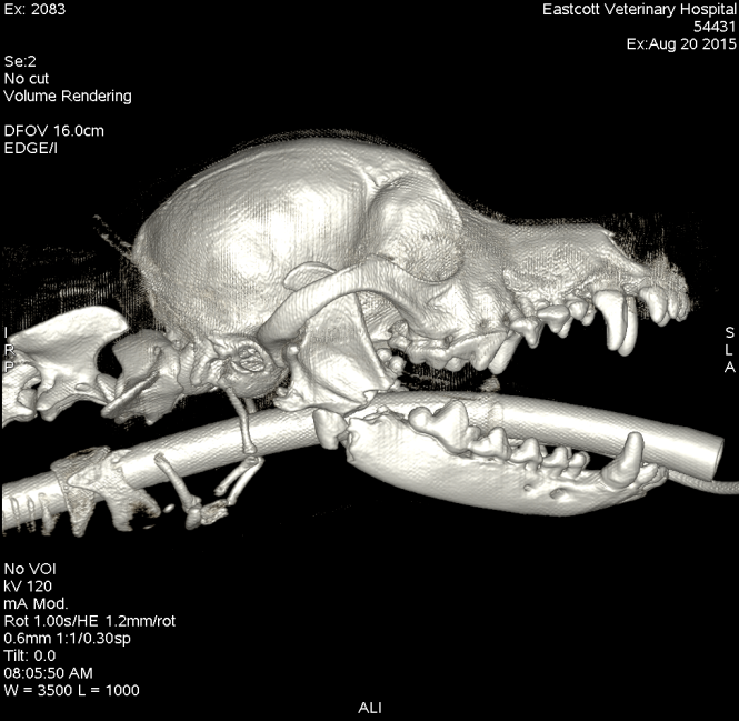 Maxillo facial fracture CT before sugery